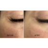 Hydra Reusable Eye Patch